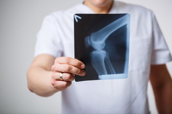 Qual é a diferença entre contusão, entorse, luxação e fratura?